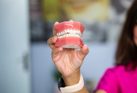 Cost of Permanent Dentures without Insurance Is 50 Percent